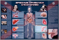 Электрифицированный стенд "Вредные привычки: алкоголизм" - «globural.ru» - Нижневартовск