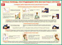 Таблица Порядок действий при опасном кровотечении 1000*1400 винил - «globural.ru» - Нижневартовск